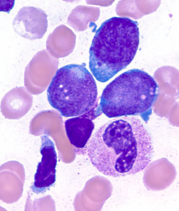 Image 6 aspirate 100x 1